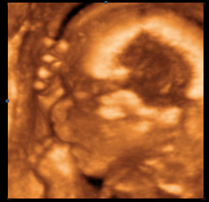 21. týden těhotenství - miminko si cucá paleček - sono