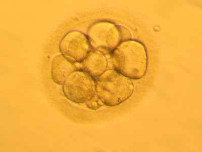 Embryo - 90 hodin