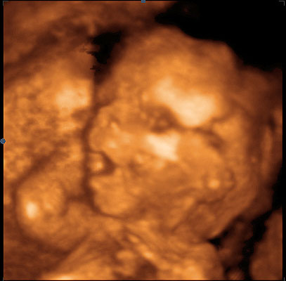 20. týden těhotenství - miminko zívá - sono
